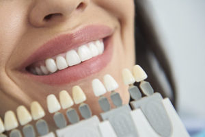 woman showing top front row of teeth, dental veneers tx