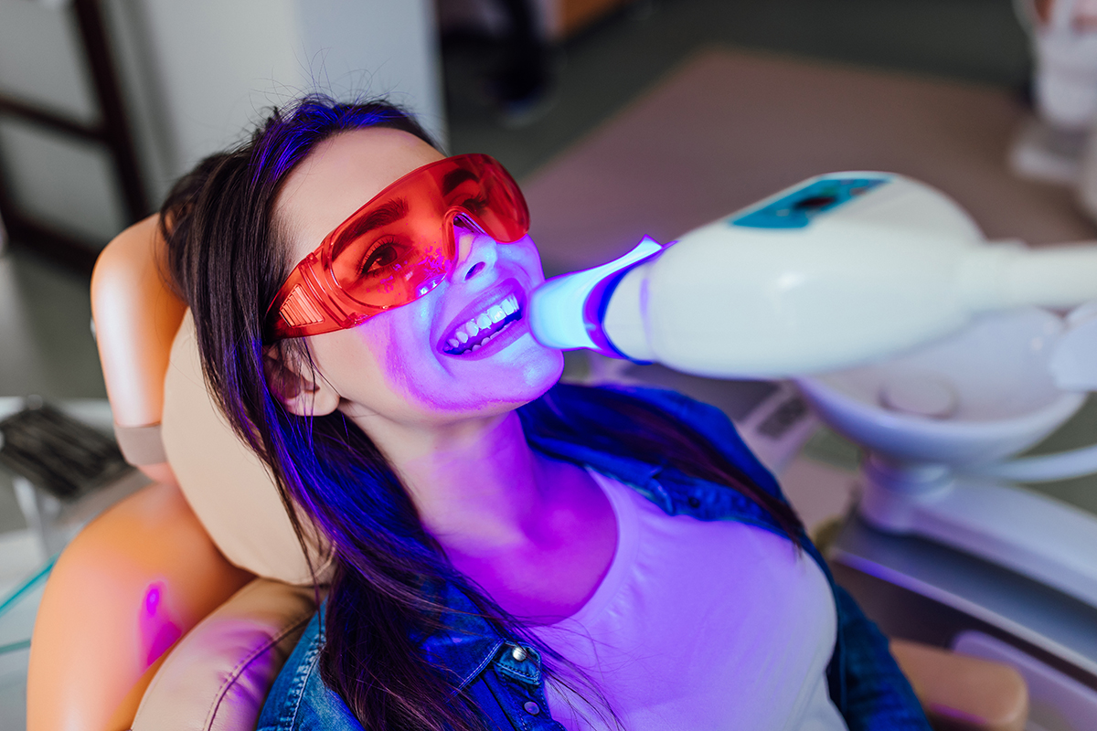 teeth whitening options (3) woman using teeth whitening options