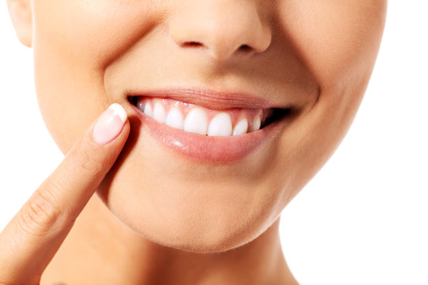 causes of receding gums woman showing causes of receding gums