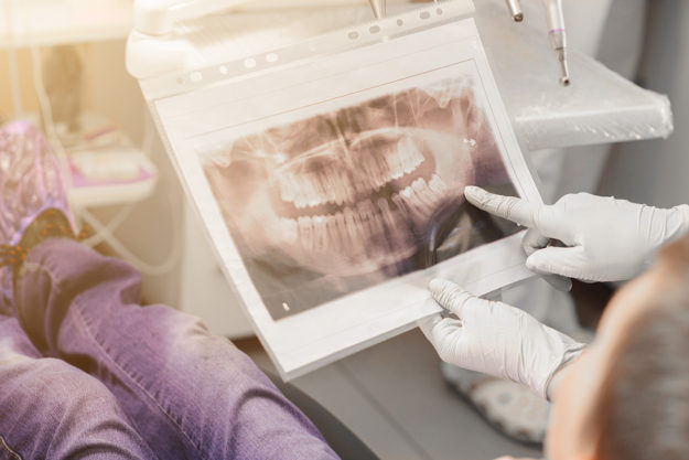 dental x rays (1) dentist looking at dental x rays