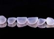 benefits of dental veneers