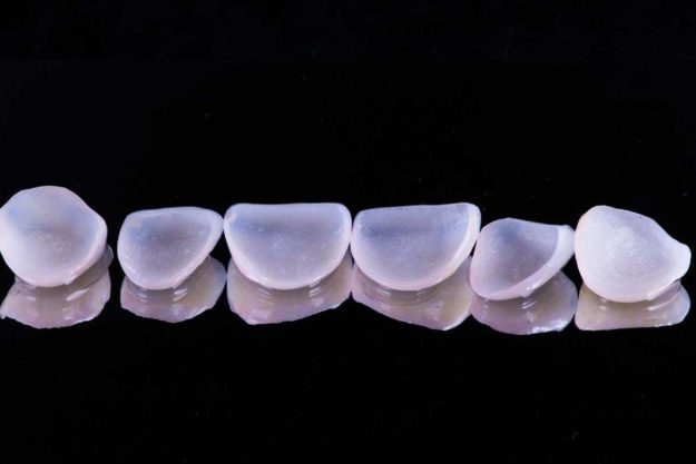 5 Benefits of Dental Veneers benefits of dental veneers