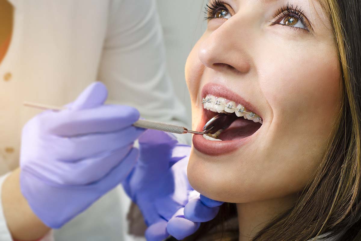 5 Signs You Need Dental Braces Again | Orthodontics Texas