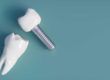 how do dental implants work
