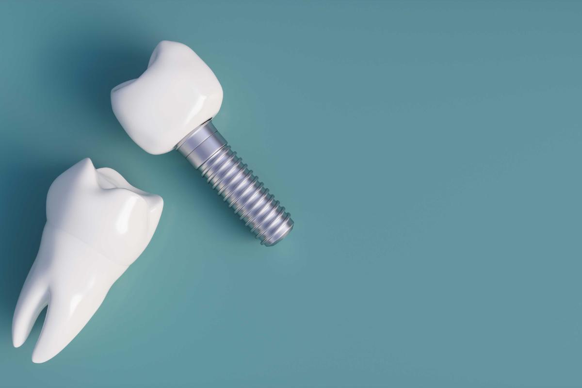 how do dental implants work
