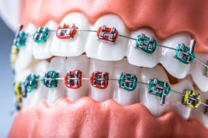 Reston Virginia Orthodontics